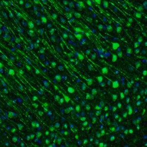 Merck Anti-GMFB antibody produced in rabbit