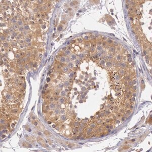 Merck Anti-CDK16 antibody produced in rabbit