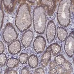 Merck Anti-COL22A1 antibody produced in rabbit