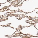 Merck Anti-TYK2 antibody produced in rabbit