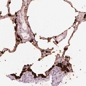 Merck Anti-STEAP1 antibody produced in rabbit