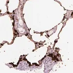 Merck Anti-STEAP1 antibody produced in rabbit