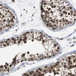 Merck Anti-UBXN1 antibody produced in rabbit