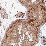Merck Anti-SIK3 antibody produced in rabbit