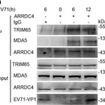 Merck Anti-TRIM65 antibody produced in rabbit