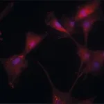 Merck Anti-Transglutaminase-2 (C-terminal) antibody produced in rabbit