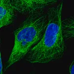 Merck Anti-LARP6 antibody produced in rabbit