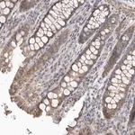 Merck Anti-UNK antibody produced in rabbit