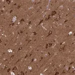 Merck Anti-MCCC1 antibody produced in rabbit