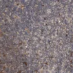 Merck Anti-TNFRSF1B antibody produced in rabbit