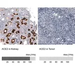 Merck Monoclonal Anti-ACE2 antibody produced in mouse