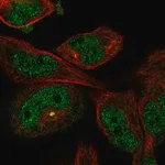 Merck Anti-MYO18B antibody produced in rabbit
