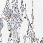 Merck Anti-LDLR antibody produced in rabbit