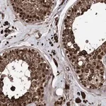 Merck Anti-ANKRD12 antibody produced in rabbit