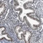 Merck Anti-YTHDC1 antibody produced in rabbit