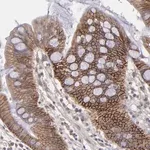 Merck ANTI-FAT1 antibody produced in rabbit