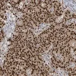 Merck Anti-KLF3 antibody produced in rabbit