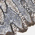 Merck Anti-PIEZO2 antibody produced in rabbit