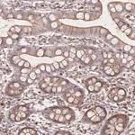 Merck Anti-FAM13A antibody produced in rabbit