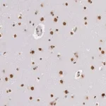 Merck Anti-HNRNPH2 antibody produced in rabbit