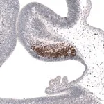Merck Anti-SKOR2 antibody produced in rabbit