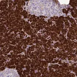 Merck Anti-AMY1A antibody produced in rabbit