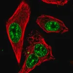 Merck Anti-RTEL1 antibody produced in rabbit