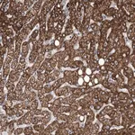Merck Anti-ANGPTL3 antibody produced in rabbit
