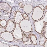Merck Anti-GLIS3 antibody produced in rabbit