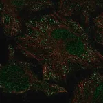 Merck Anti-PIEZO2 antibody produced in rabbit