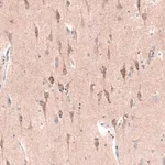 Merck Monoclonal Anti-CTGF antibody produced in mouse