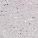 Merck Anti-FGD1 antibody produced in rabbit