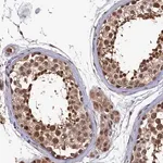 Merck Anti-CLPX antibody produced in rabbit