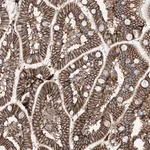 Merck Anti-ATP11C antibody produced in rabbit