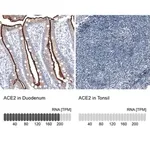 Merck Monoclonal Anti-ACE2 antibody produced in mouse