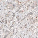 Merck Monoclonal Anti-CDK5RAP2 antibody produced in mouse