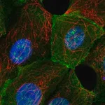 Merck Anti-MAPT antibody produced in rabbit