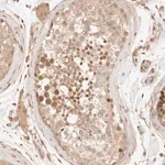 Merck Anti-TRIM11 antibody produced in rabbit
