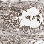 Merck ANTI-EXD2 antibody produced in rabbit