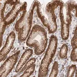 Merck Anti-RNF213 antibody produced in rabbit
