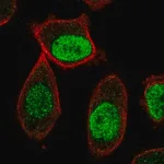 Merck Anti-CENPA antibody produced in rabbit