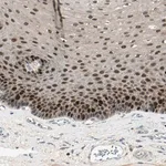 Merck Anti-PITX1 antibody produced in rabbit
