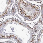 Merck Anti-AGAP1 antibody produced in rabbit