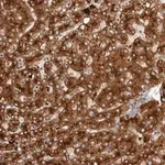 Merck Anti-AGL antibody produced in rabbit
