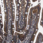 Merck Anti-DENND4C antibody produced in rabbit