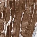 Merck Anti-ZCCHC6 antibody produced in rabbit