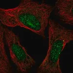 Merck Anti-ATXN3 antibody produced in rabbit