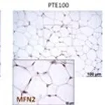 Merck Anti-MFN2 antibody produced in rabbit