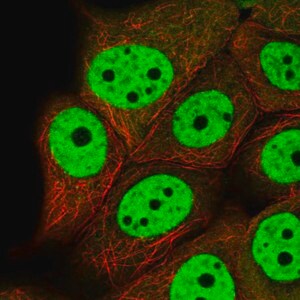Merck Anti-VHL antibody produced in rabbit