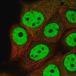 Merck Anti-VHL antibody produced in rabbit